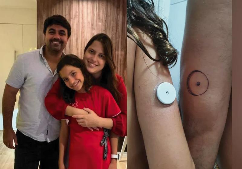 Pai tatua sensor de glicose para apoiar filha diabética que usa o aparelho