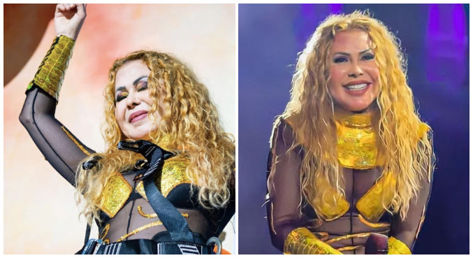 Joelma preocupa fãs com rosto inchado e assessoria explica: 'Sequelas da Covid' 