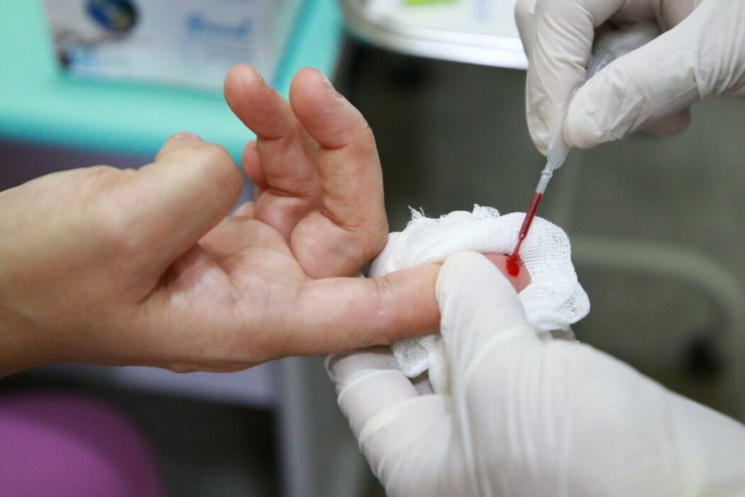 Vermelho: SES-AM alerta para prevenção, diagnóstico e tratamento das hepatites virais