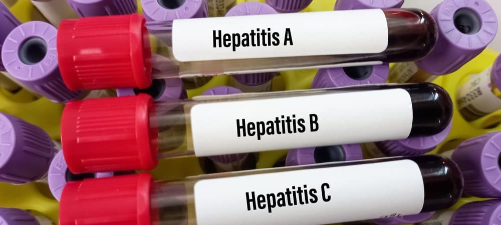 Ministério da Saúde investiga 58 casos de hepatite infantil misteriosa