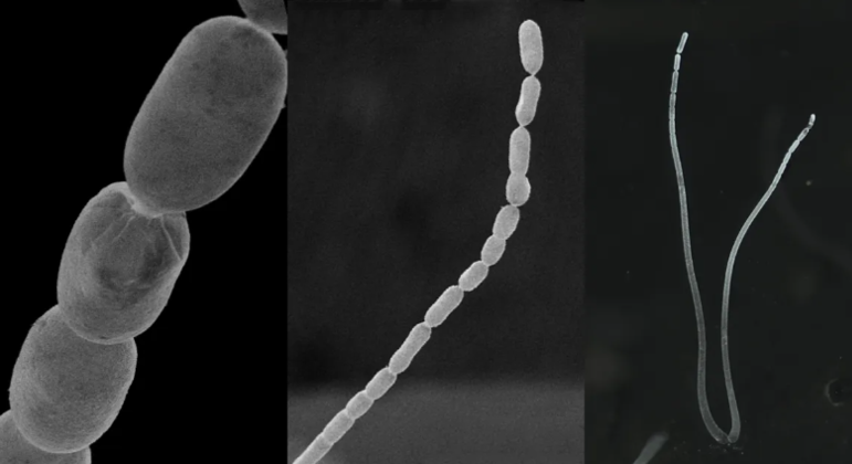 Maior bactéria do mundo surpreende cientistas com características nunca vistas