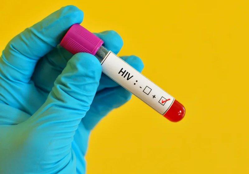 4º caso de cura do HIV no mundo recebeu transplante de medula