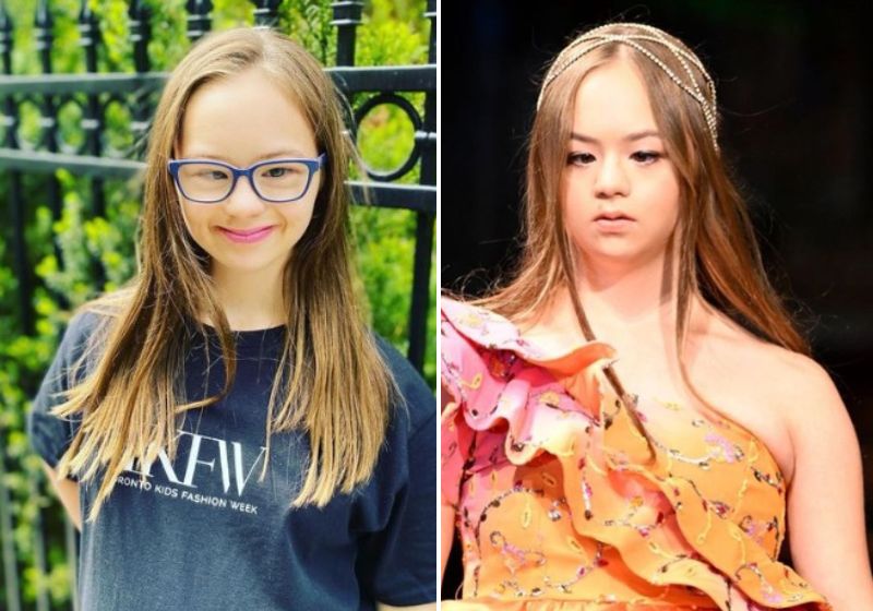 Adolescente com Down brilha como modelo na NY Fashion Week e é contratada