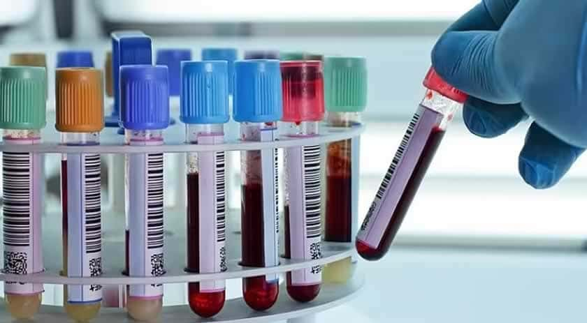 Novo exame de sangue pode detectar 50 tipos de câncer em estágio inicial