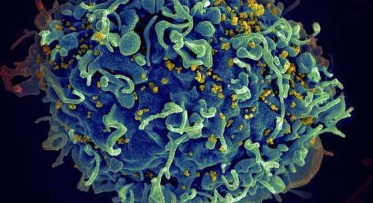 Homem de 53 anos é o quinto paciente curado do HIV após transplante de células-tronco
