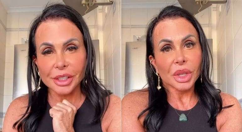 Gretchen rebate críticas, desmente harmonização e diz: 'Se eu quiser ficar parecendo Fofão, vou ficar'