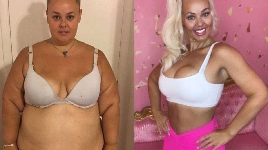 Influenciadora australiana tem ajuda de Barbie para perder 90 kg e mudar de vida