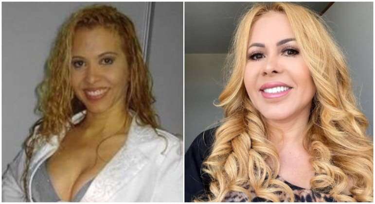 Harmonização facial e cabelo ruivo: veja as grandes mudanças de Joelma