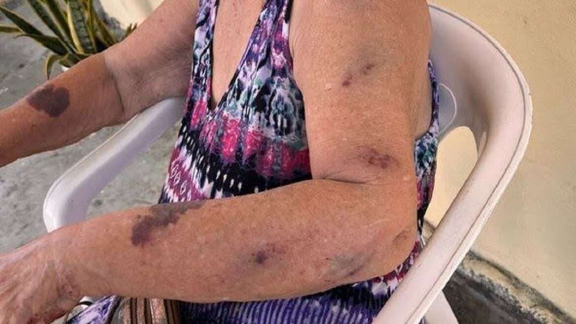 Polícia resgata idosa de 87 anos que era agredida a vassouradas pela neta