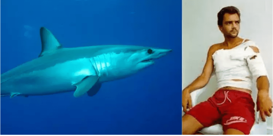 Homem leva mais de 300 pontos após ataque de tubarão e diz que golfinhos o ajudaram