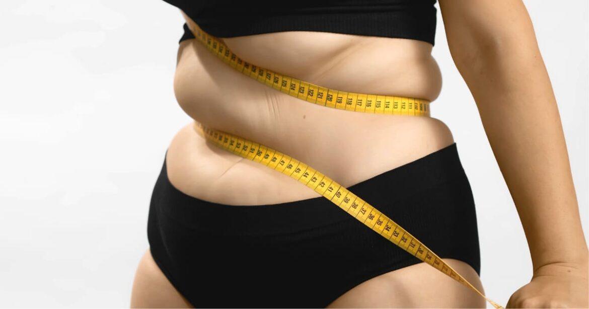 Obesidade: mudança de hábitos e estilo de vida pode combater a doença