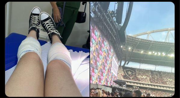 Fã de Taylor Swift sofre queimadura de segundo grau em estádio por conta de estrutura metálica