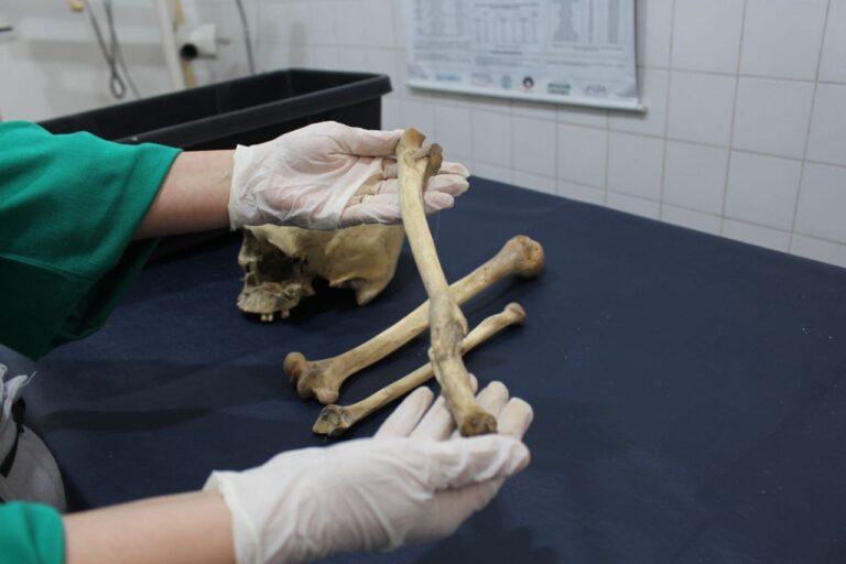 Peritos do Amazonas usam antropologia forense para identificar ossadas humanas