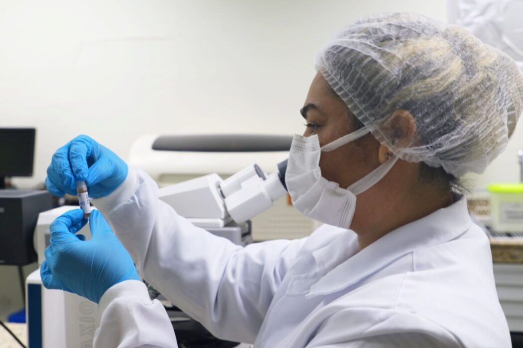 Sem novos casos de Mpox: Amazonas divulga atualização epidemiológica