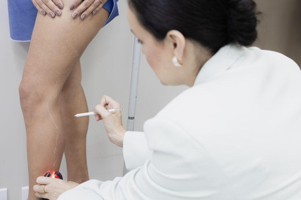 Cinco sinais que podem indicar problemas na circulação