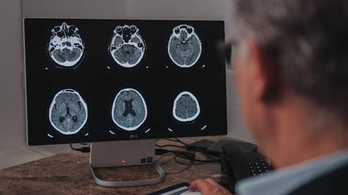 Setembro é o mês de conscientização do aneurisma cerebral