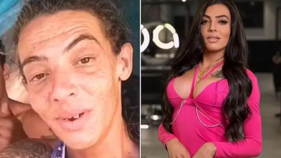 Influenciadora que viveu nas ruas faz 10ª cirurgia e impressiona