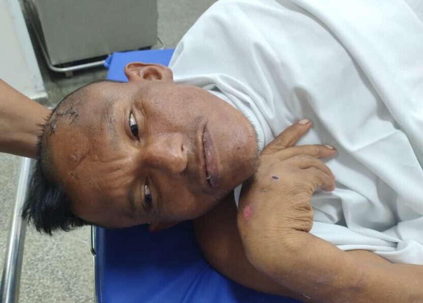 Hospital João Lúcio pede ajuda para localizar familiares de paciente internado sem identificação