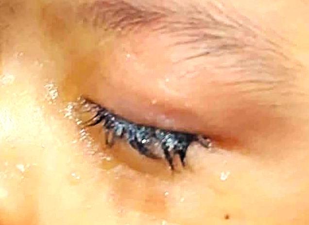 Criança de 2 anos cola os próprios olhos e é internada em hospital no interior do AM