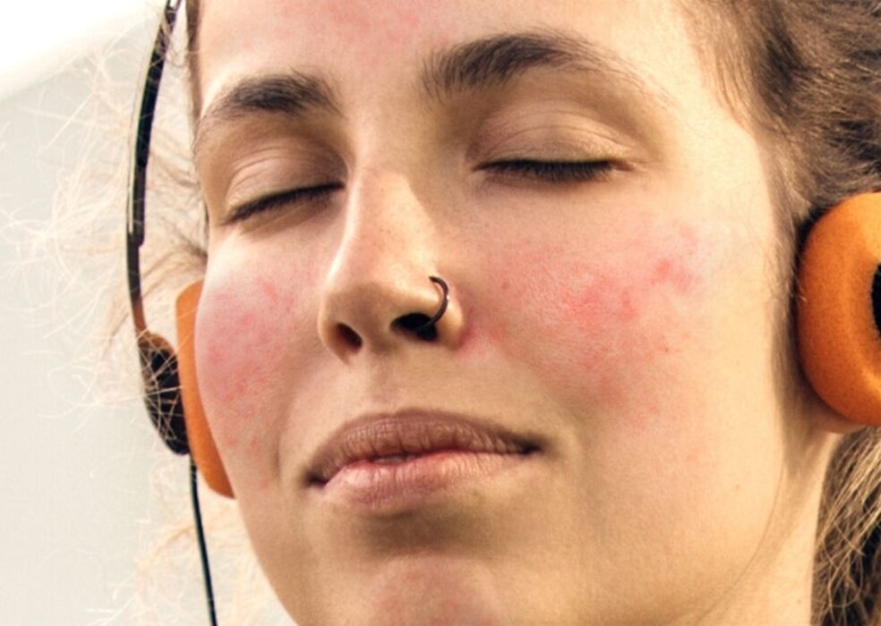 Pele sensível: especialista alerta para sinais e tratamentos