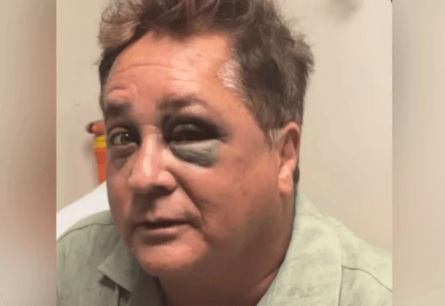 Leonardo sofre queda no Pantanal e esposa atualiza estado de saúde