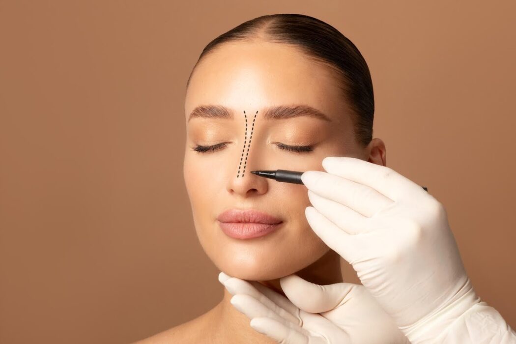 Rinoplastia associa correção estética e função respiratória