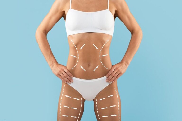 Avanços tecnológicos ampliam resultados da lipoaspiração