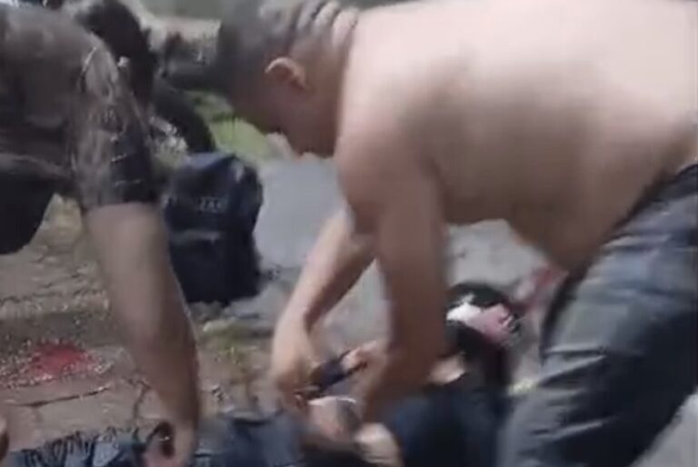 Motociclista tem perna esmagada em acidente de trânsito em avenida de Manaus