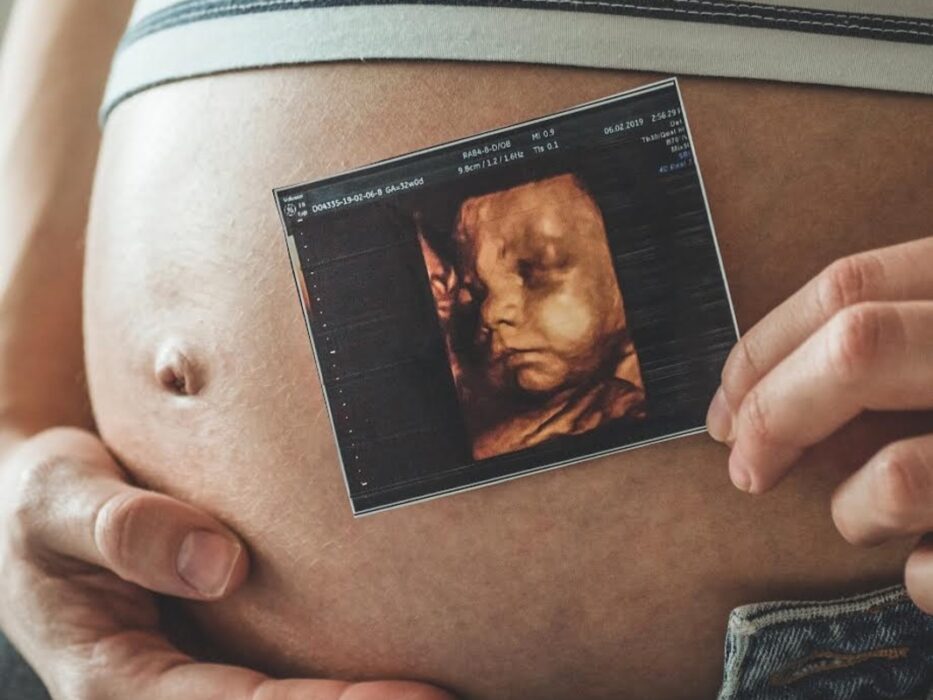 Ultrassonografia obstétrica avança no diagnóstico pré-natal